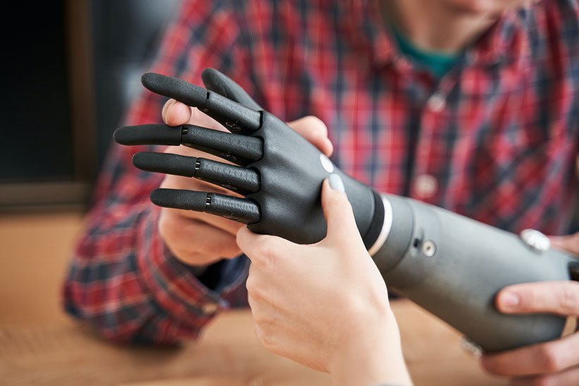 a custom prosthetic arm